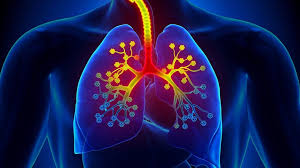 Asthma-images